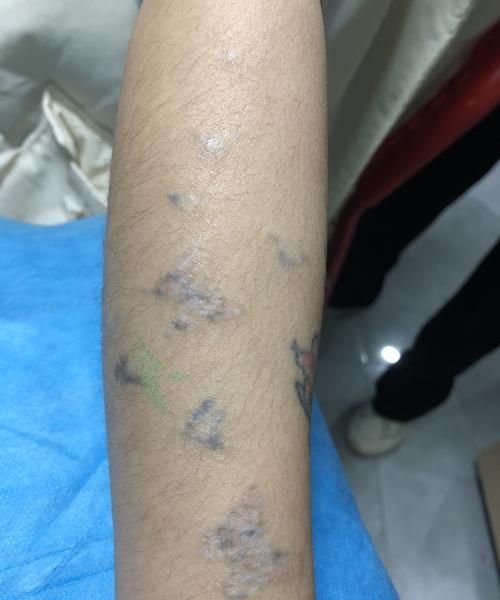 洗纹身能把颜色洗得一干二净吗