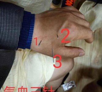 ​七针之刑是哪七针,七针针法怎么分