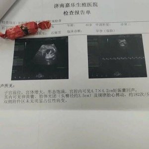 ​怀孕三个月的症状有哪些(怀孕三个月的症状和表现形式)