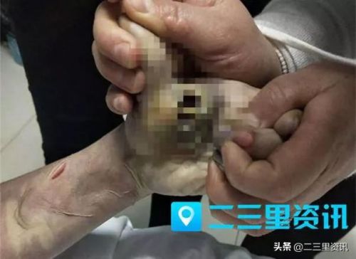 玩手机时触电身亡原因(三招教孩子不玩手机)-第2张图片-