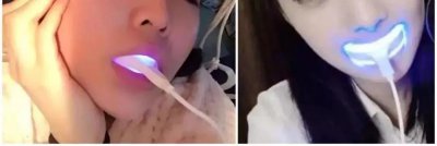 ​在朋友圈刷屏的冷光美牙仪，背后藏着哪些不能说的秘密