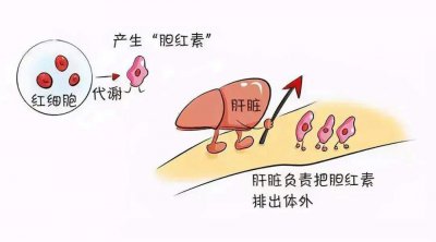 ​胆红素升高是什么原因导致的? 胆红素升高怎么回事?