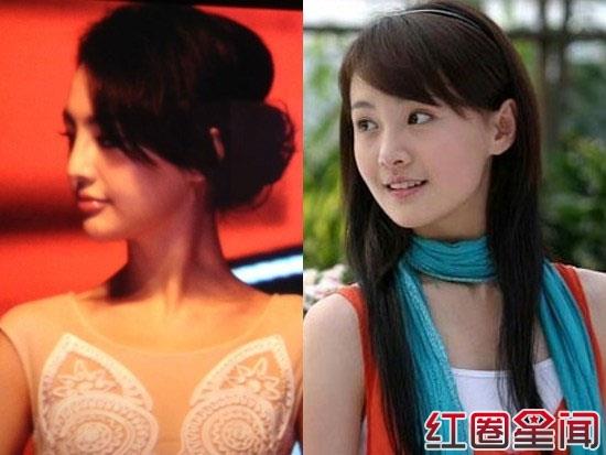 郑爽整容了吗 郑爽整形前后对比照片