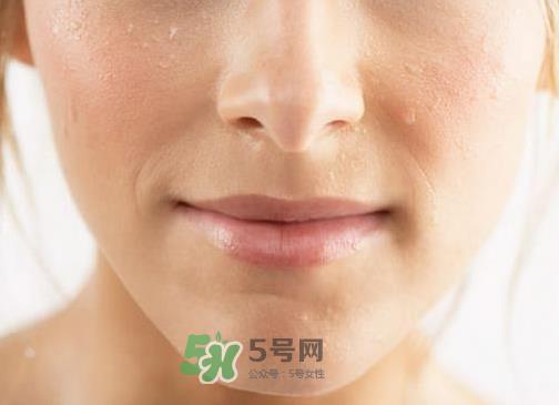 三伏天出汗是排毒还是体虚？三伏天出汗多能减肥吗？