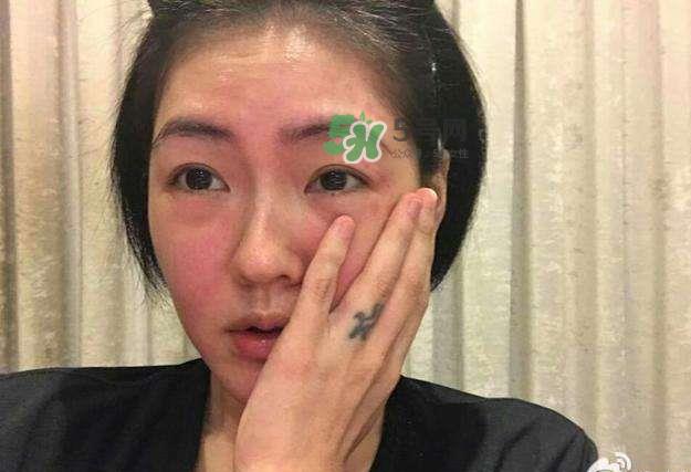 适合敏感肌用的护肤品 敏感肌适合用什么护肤品
