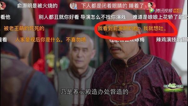 俞灏明被烧毁容，30拍戏被骂想吐，他说完全是猪头？