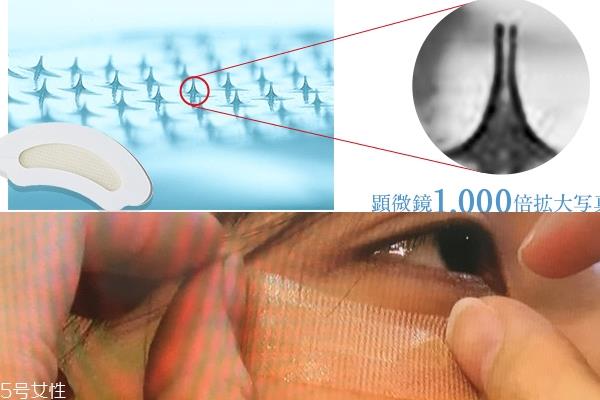 微针眼膜能天天使用吗 一个礼拜用一次