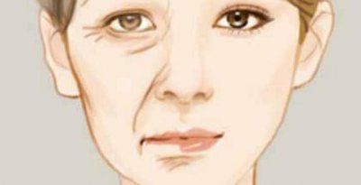 ​怎样去除皱纹？最好的7个方法