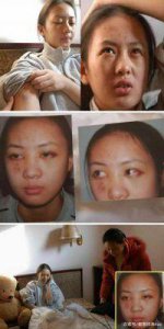 ​童谣曾遭受张默的暴力袭击，如今事业正蓬勃发展