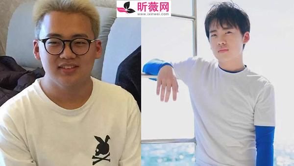 郭麒麟肥胖照片 郭麒麟胖的时候图片