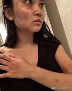​蒋劲夫再次家暴女友！网友：他该去看心理医生了