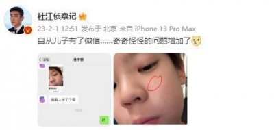 ​孩子长大了！嗯哼长青春痘了 杜江晒聊天记录