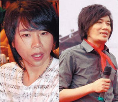 卢庚戌整容前后照片对比