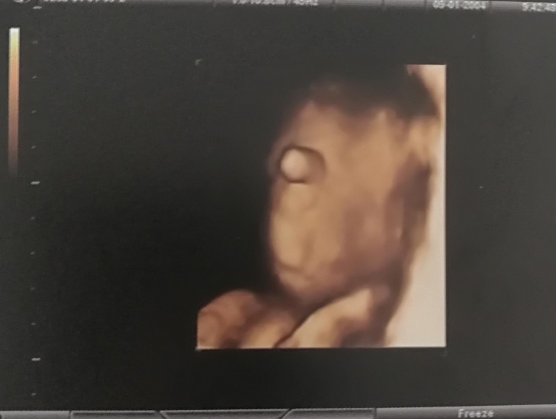 谷爱凌个人资料简介(揭秘谷爱凌身世)