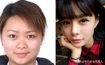​沈梦辰整容了了吗(沈梦辰第二次整容前后对比照)