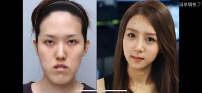 ​浅谈韩国整形