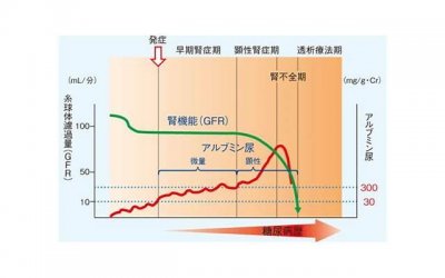​张柏芝的妈妈（59岁张柏芝妈妈近况落魄）