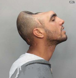 ​世界半脑人的世界是怎么样的？会影响到正常生活吗？